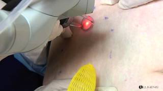 Laser Cliniqúe