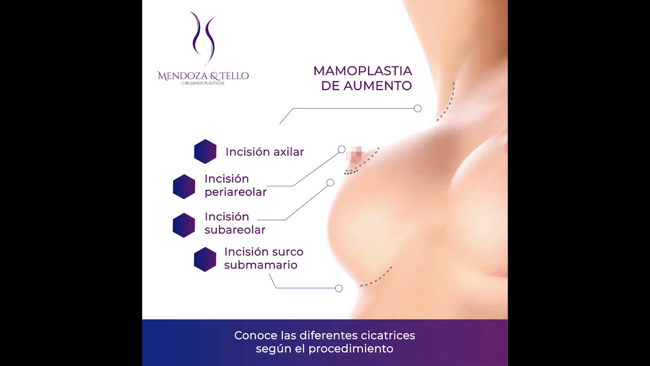 Alexander Mendoza-114