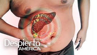 Qué tomar para limpiar el hígado graso (y otras dudas de salud) | Dr. Juan