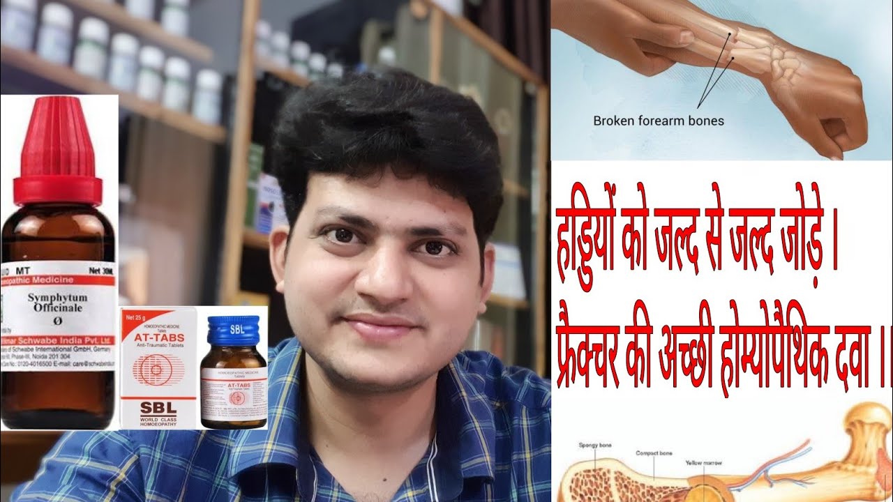 Fracture | Homeopathic medicine for Fracture  हड्डियों को जल्दी से जोड़ने की होम्योपैथिक दवा | #
