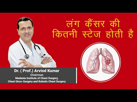 Stages of Lung Cancer