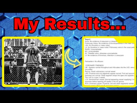 Steroids for 9 Years… Here's What They Did to My Heart