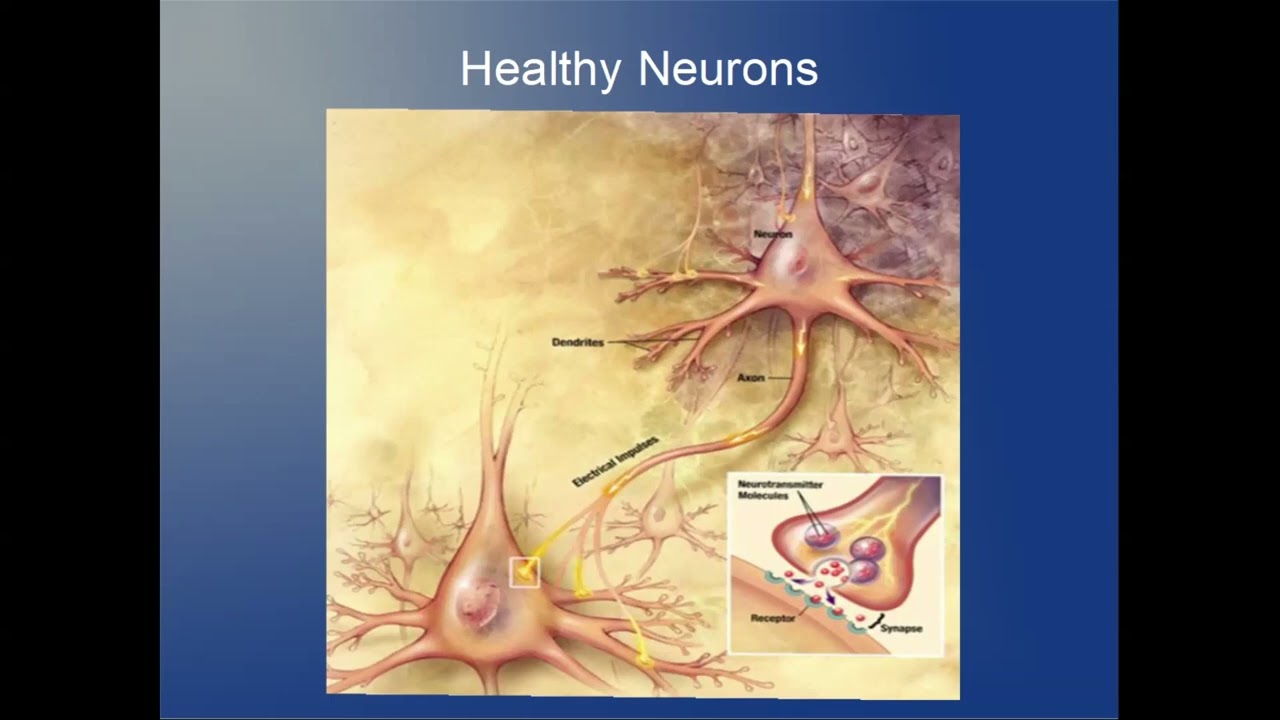 Understanding Different Types of Dementia
