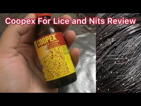 How to remove Head Lice and Nits in One day. Coopex Anti Lice Lotion Review does it work or not?