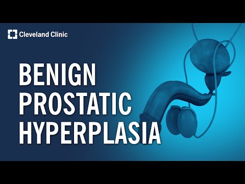 What Causes An Enlarged Prostate? | BPH Explained