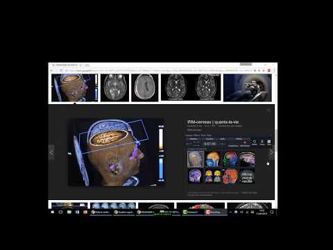 Médicaments de stabilisation pression artérielle chez les personnes âgées Dr bouchers et lhypertension