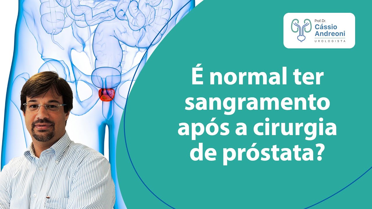 É normal ter sangramento após a cirurgia de próstata? | Dr. Cassio Andreoni CRM 78.546
