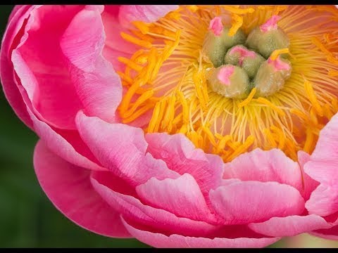 Xenius MRT und CT: Welche Chancen, welche Risiken? (Dokumentation HD)