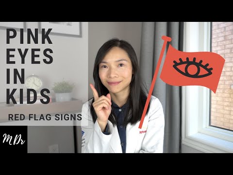 Red Eyes in Children | Common Causes & Red Flag Signs