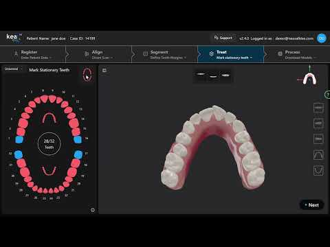 Mark Stationary Teeth