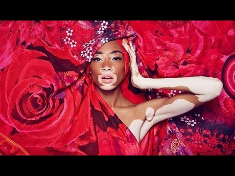 Bellezza di aichun che candeggia la crema La crema che candeggia risposte di Bella Jardine
