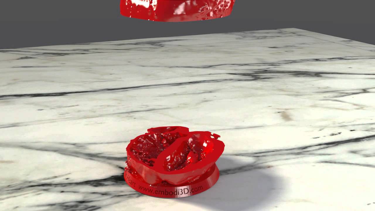 3D Printable Human Heart Model with Stackable Slices