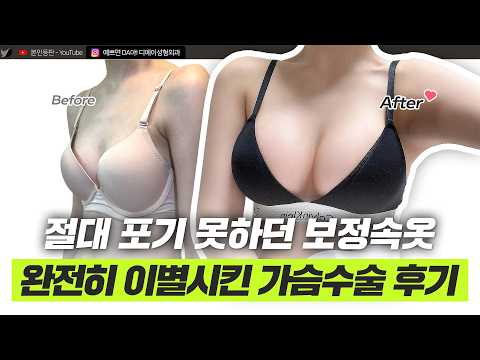 옷 태가 달라지는 마법! 핏이 예뻐지는 가슴성형 후기 브이로그ㅣ디에이성형외과ㅣ모티바가슴성형