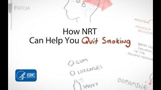 Nicotine Affects the Brain. Nicotine Replacement Therapy (NRT) Can Help You Quit Smoking.