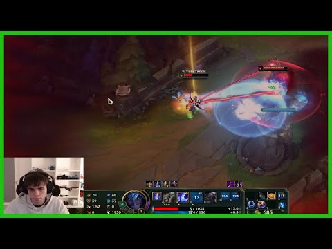 Vetheo Experiences Brain Lag