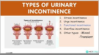 Types of Urinary Incontinence EXPLAINED, Stress, urge, functional, overflow incontinence