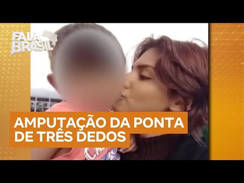 Criança brasileira sofre amputação após agressão em escola de Portugal