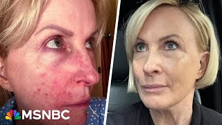 'I looked grotesque': Mika shares ugly truth about products that made her sick