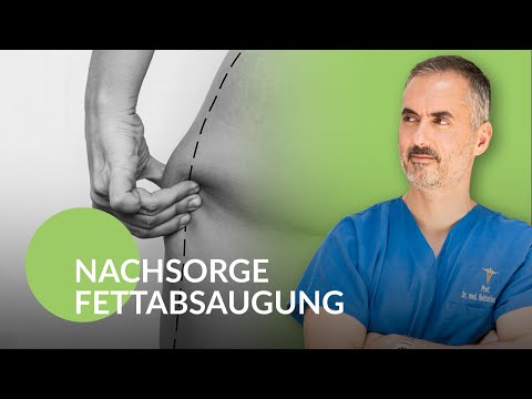 SINIS CARE – Liposuction: What should you pay attention to during aftercare?