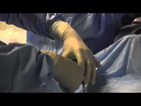 download lagu mp3 mp4 How To Get Rid Of Calcium Deposits, download lagu How To Get Rid Of Calcium Deposits gratis, unduh video klip How To Get Rid Of Calcium Deposits