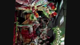 Mortician "Claws of Death"