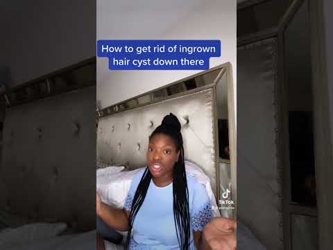 How to get rid of ingrown hair cyst after wax/shave