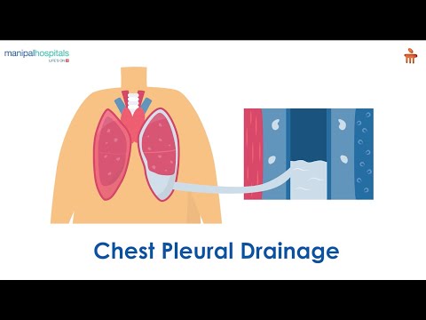 What is Chest Pleural Drainage? l Manipal Hospitals Bengaluru