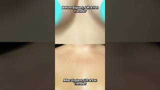 Lampert Md Plastic Surgery