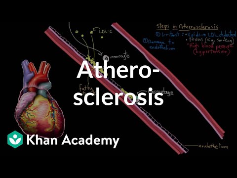 Atherosclerosis | Circulatory System and Disease | NCLEX-RN | Khan Academy