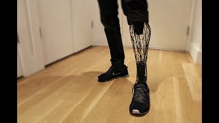 Top Future Prosthesis You Never Seen!