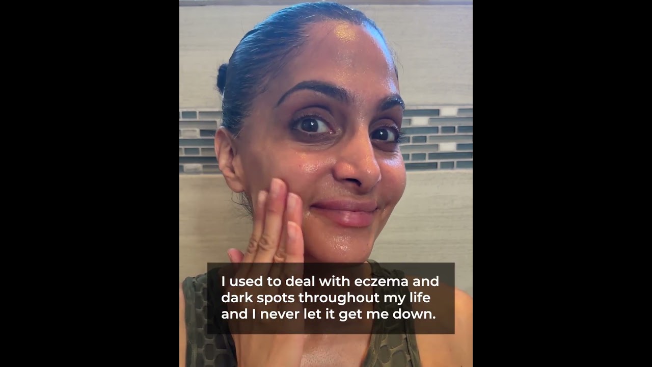 BioFormula Select Review - Stop Guessing Dark Spot Removal