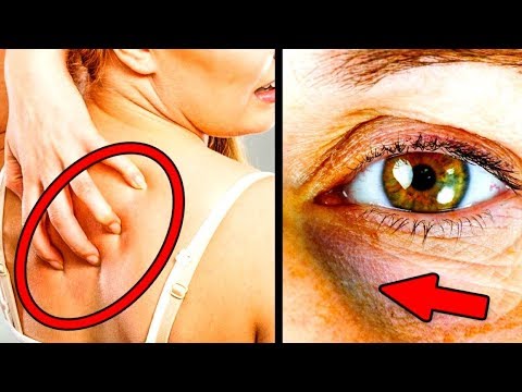 Wie funktioniert Diabetes beim Kind Wie man den Blutzucker in einem Kind regulieren