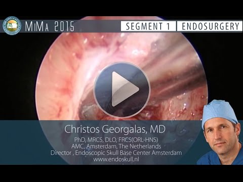 Masterclip # 3 Draf III _ Come meet Christos Georgalas at MiMa 2015