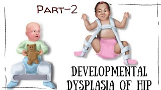 DEVELOPMENTAL DYSPLASIA OF HIP || PART-2 || DDH || DYSPLASTIC HIP || BARLOW
