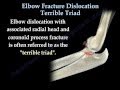 Elbow Fracture Dislocation Terrible Triad Everything You Need To Know Dr Nabil Ebraheim