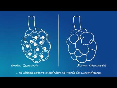Übungen für die Behandlung von Bluthochdruck Atem Propranolol für hypertensive Krise