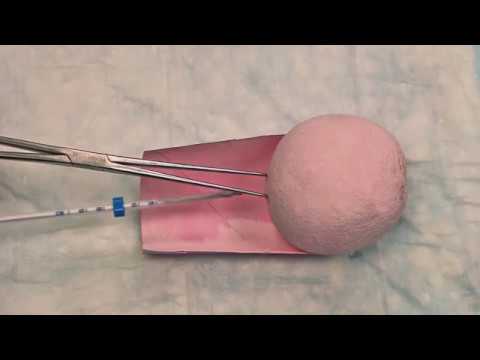 Hormonal IUD (LNG-IUS) Insertion Technique