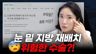 눈 밑 지방 재배치 위험한 수술이라고? 눈밑지 고민인 사람들 필수시청!✨
