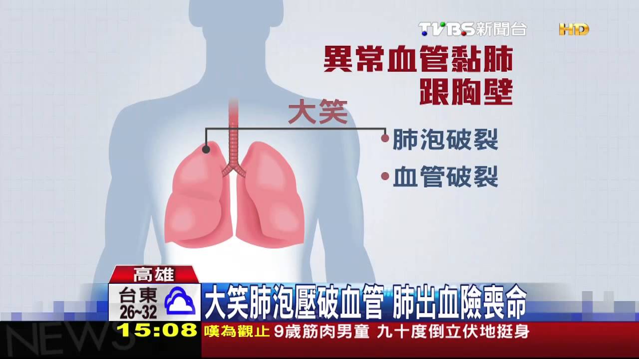 蝦咪!笑太開心肺出血 男險喪命