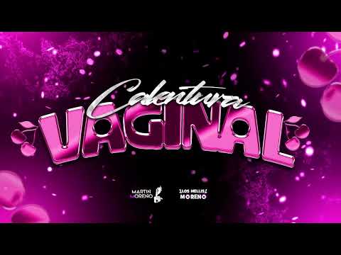 CALENTURA VAGINAL - MARTIN MORENO FT LOS MELLIS MORENO