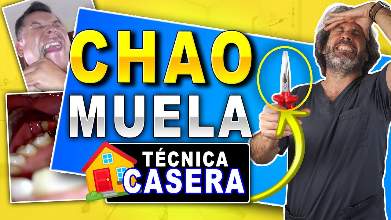 𝗗𝗲𝗻𝘁𝗶𝘀𝘁𝗮 𝗥𝗘𝗔𝗖𝗖𝗜𝗢𝗡𝗔: Como 𝐒𝐀𝐂𝐀𝐑 una 𝐌𝐔𝐄𝐋𝐀 Rota en 𝗖𝗔𝗦𝗔 𝗦𝗜𝗡 𝗗𝗢𝗟𝗢𝗥! (Quitar dientes SIN IR AL DENTISTA)