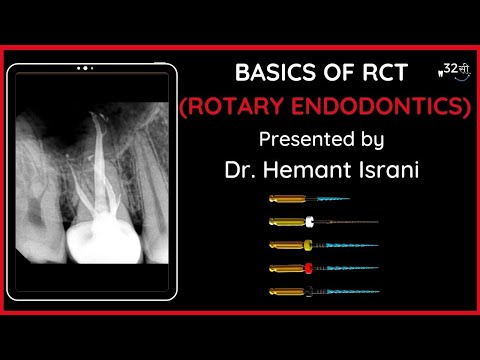 BASICS of RCT | ROTARY ENDODONTICS - Step by Step | TIPS & TRICKS!!
