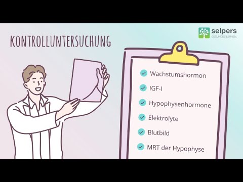 Akromegalie und Kontrolluntersuchungen – Welche und wie oft? (Experte erklärt)