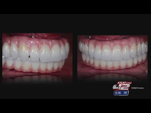 VIDEO: CAD CAM: Making New Teeth