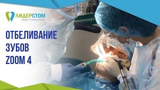 Отбеливание зубов ZOOM4 💎 Противопоказания лазерного отбеливания зубов