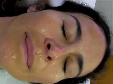 Il sostegno di traccia di una canzone dellustione di lentiggini di ragazza Come chiarificare pigmentary nota un cetriolo