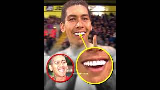 What teeth do footballers have? 😁