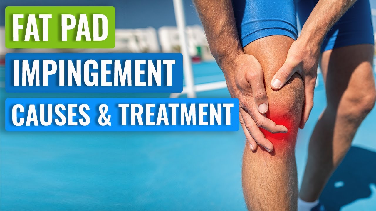 Hoffa’s (Knee) Fat Pad Impingement Syndrome - Causes & Treatment