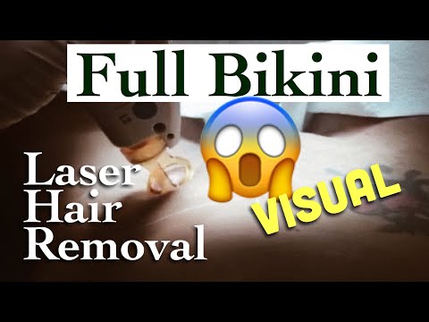 download lagu mp3 mp4 Female Hollywood Laser, download lagu Female Hollywood Laser gratis, unduh video klip Female Hollywood Laser