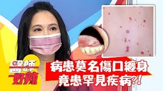病患莫名傷口纏身？竟患罕見疾病「天疱瘡」？！【#醫師好辣】20210823 part3 EP1187 林道遠 柯世祐